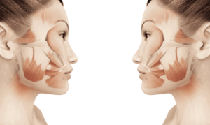 Using Facial Structure to Maximize Beauty, a comparison of a woman's facial muscles is shown side by side.