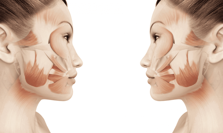 Using Facial Structure to Maximize Beauty, a comparison of a woman's facial muscles is shown side by side.