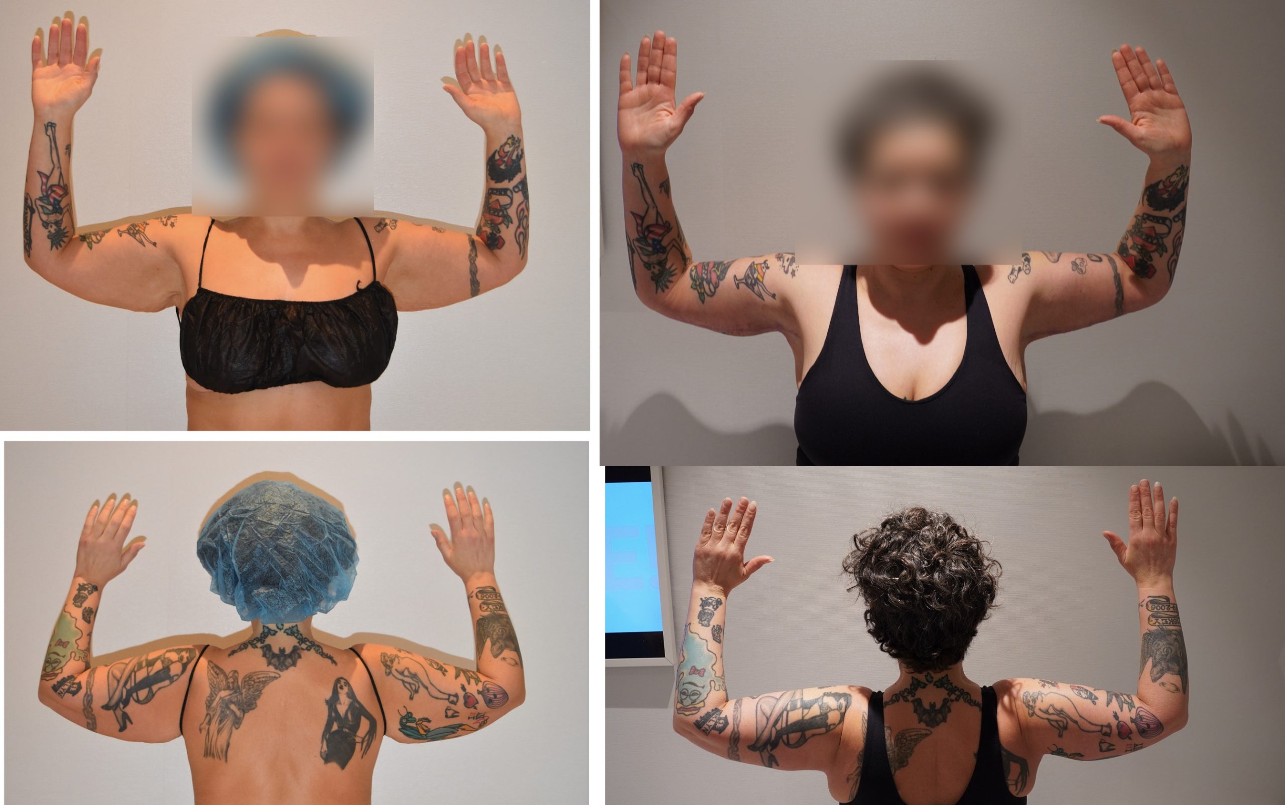 A collage of before and after photos featuring a woman with tattoos.
