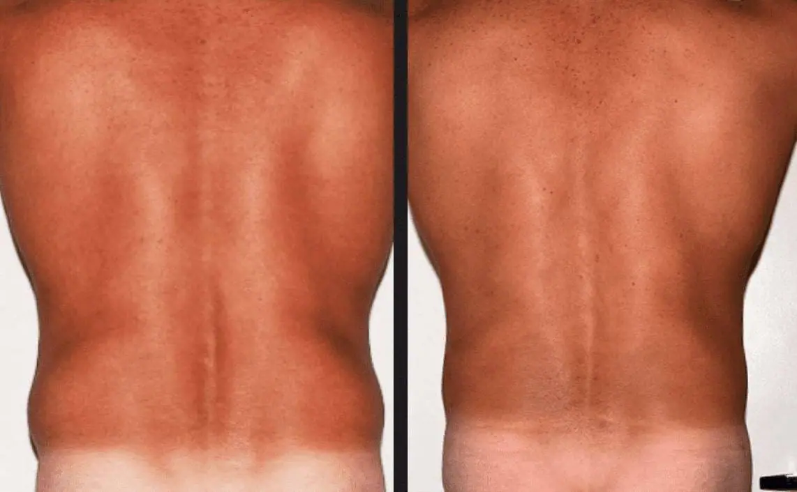 A man's back before and after a tan, showcasing the transformation with a sun-kissed glow.