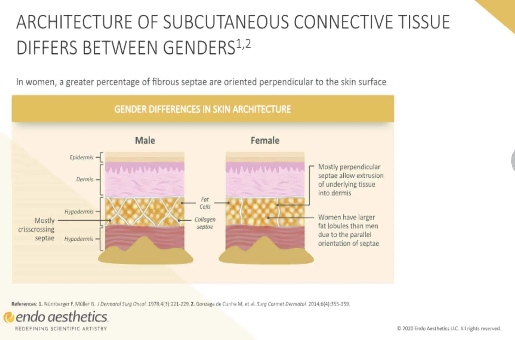 The structure of subcutaneous connective tissue differs between genders, particularly in relation to QWO.