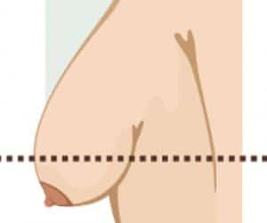 A diagram showing the size of a woman's breasts.