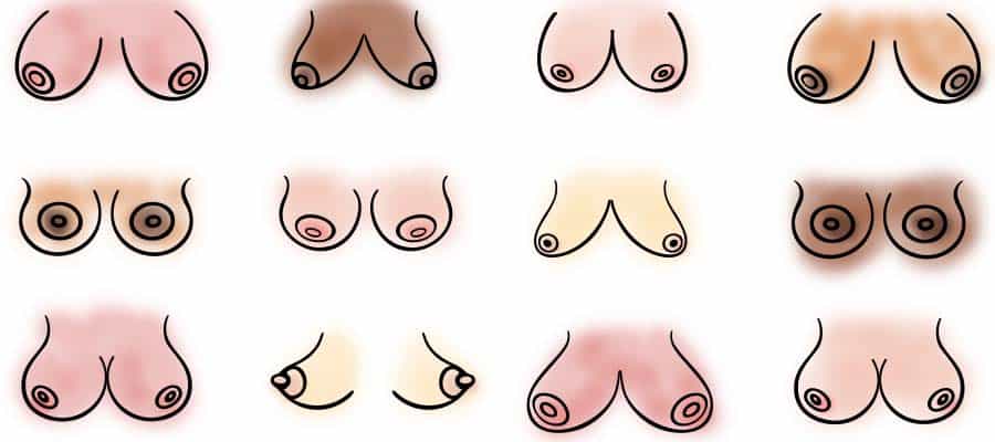 Different types of breasts with different shapes and sizes.