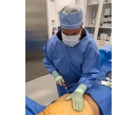 A surgeon is performing abdominal surgery on a patient.