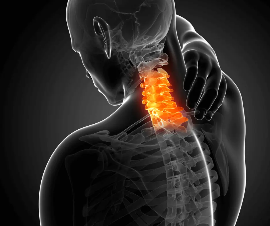A man with a neck pain and a hump is shown.