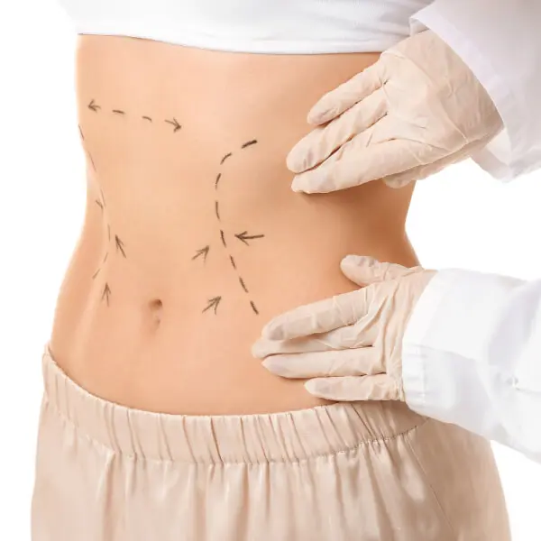 An image of a woman's abdomen with an arrow pointing to her stomach.
