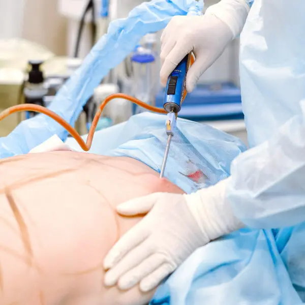 A surgeon is performing stomach surgery on a patient in an operating room.