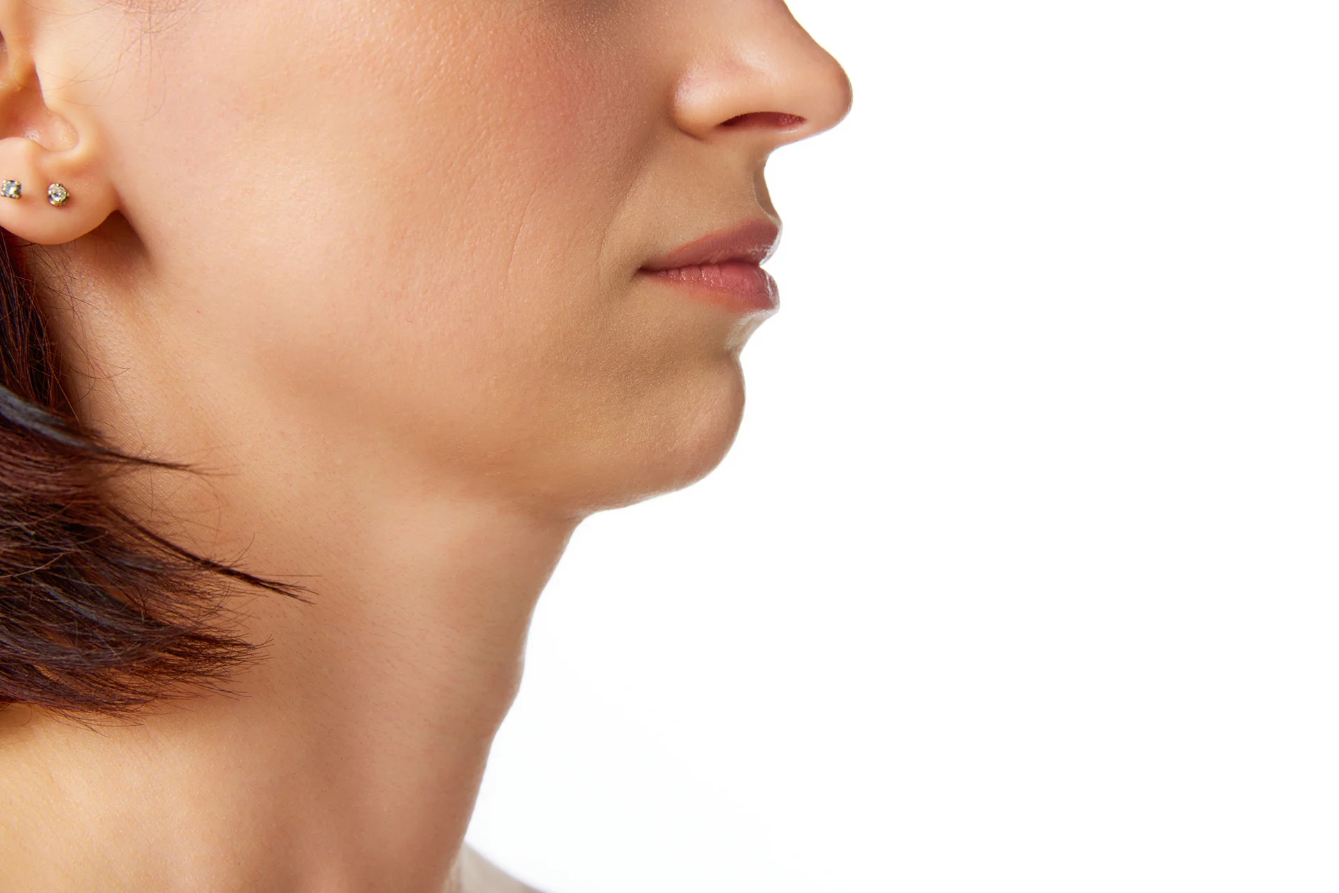 chin liposuction treatment