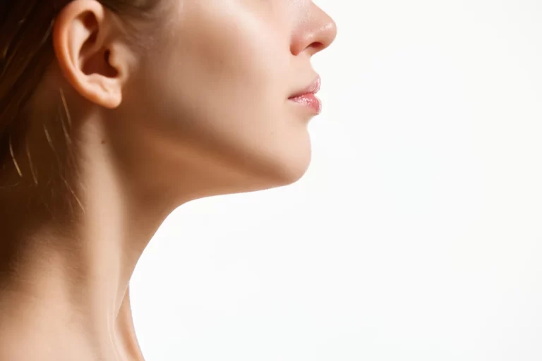 Neck lift vs Chin liposuction
