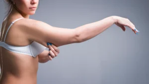 Side view of a woman in a white bra pinching the skin on her upper arm, focusing on aesthetic results.